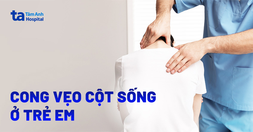Cong vẹo cột sống ở trẻ em